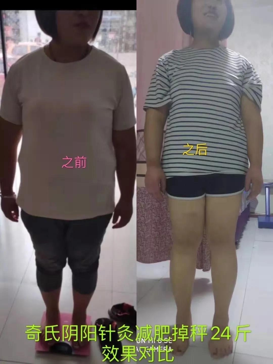 金华周海燕徒手移容术培训班费用
