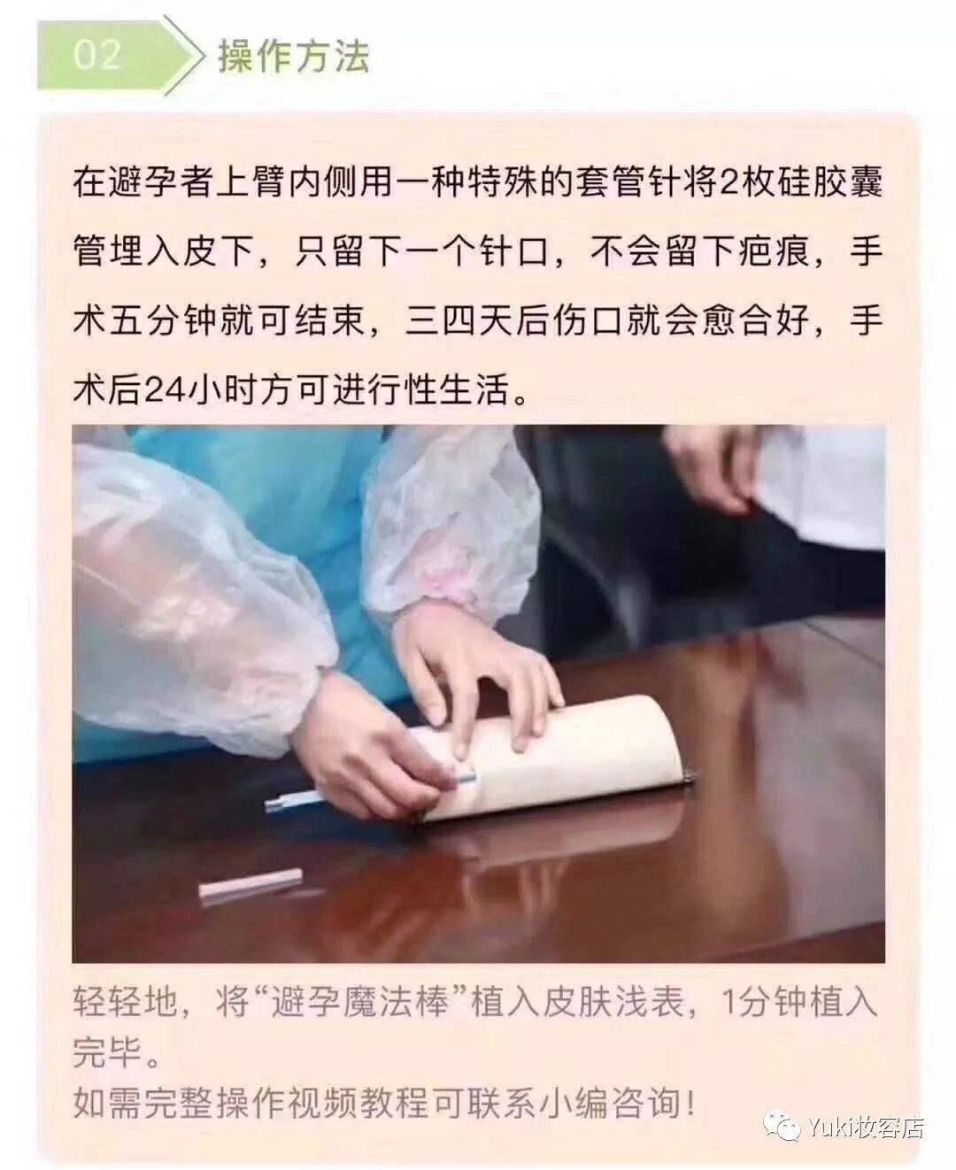 包教包会的埋线避孕培训