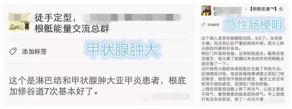 北京昌平区吴金乐跟骶推拿按摩培训班能调理食道癌吗