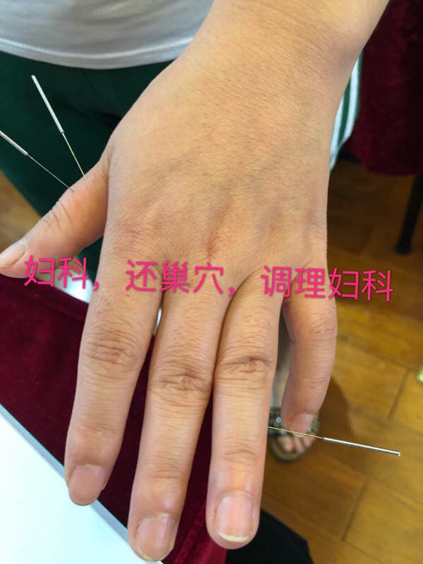 长春正宗董氏奇穴