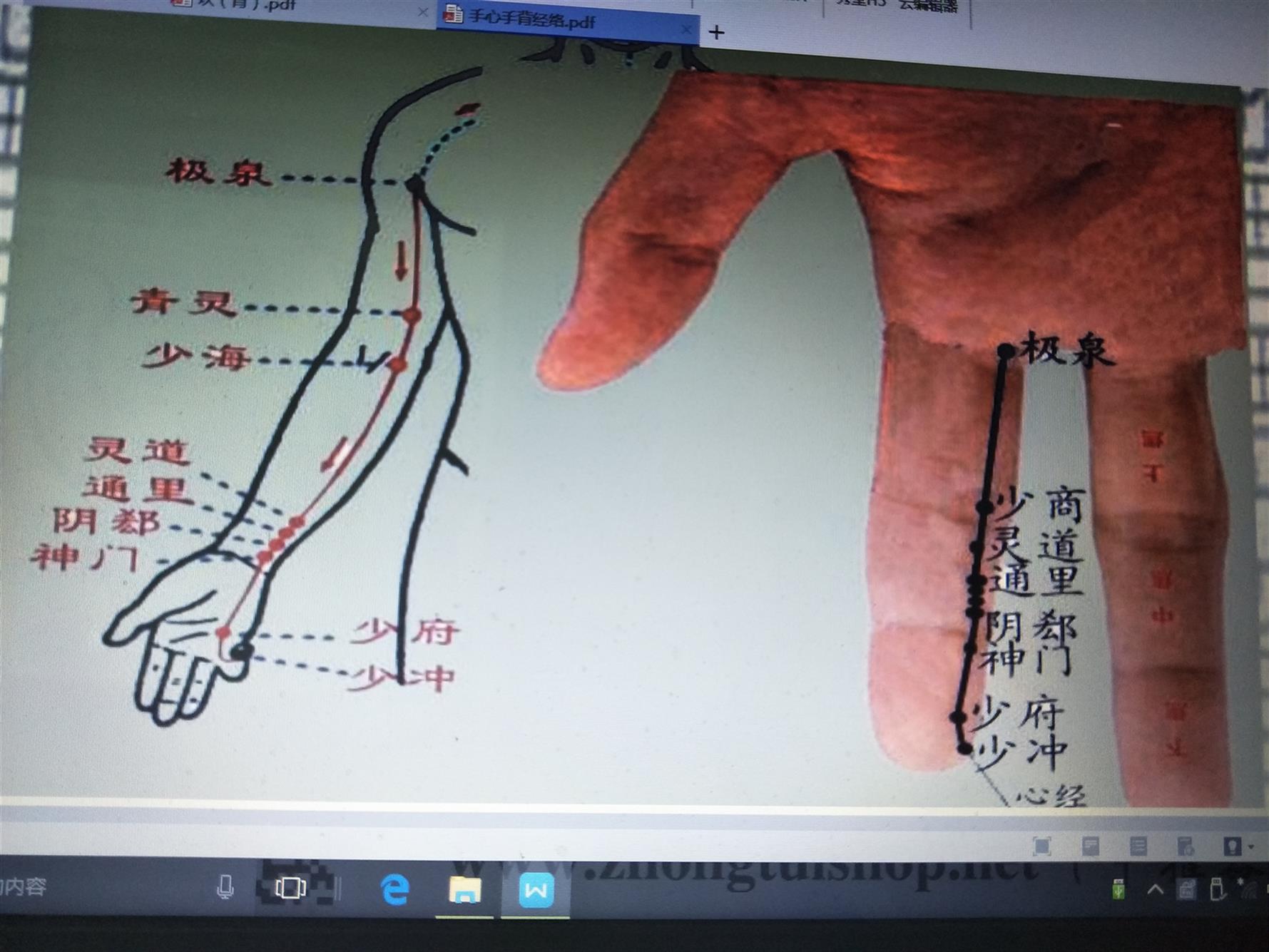 成都邱飞虎闪电类疼痛病缓解类疼痛病培训费用 闪电针
